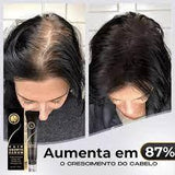 (PAGUE 1 LEVE 2) Repair Hair® - Diminui Queda Em 95% E Aumenta Crescimento Em 20x - cariri store